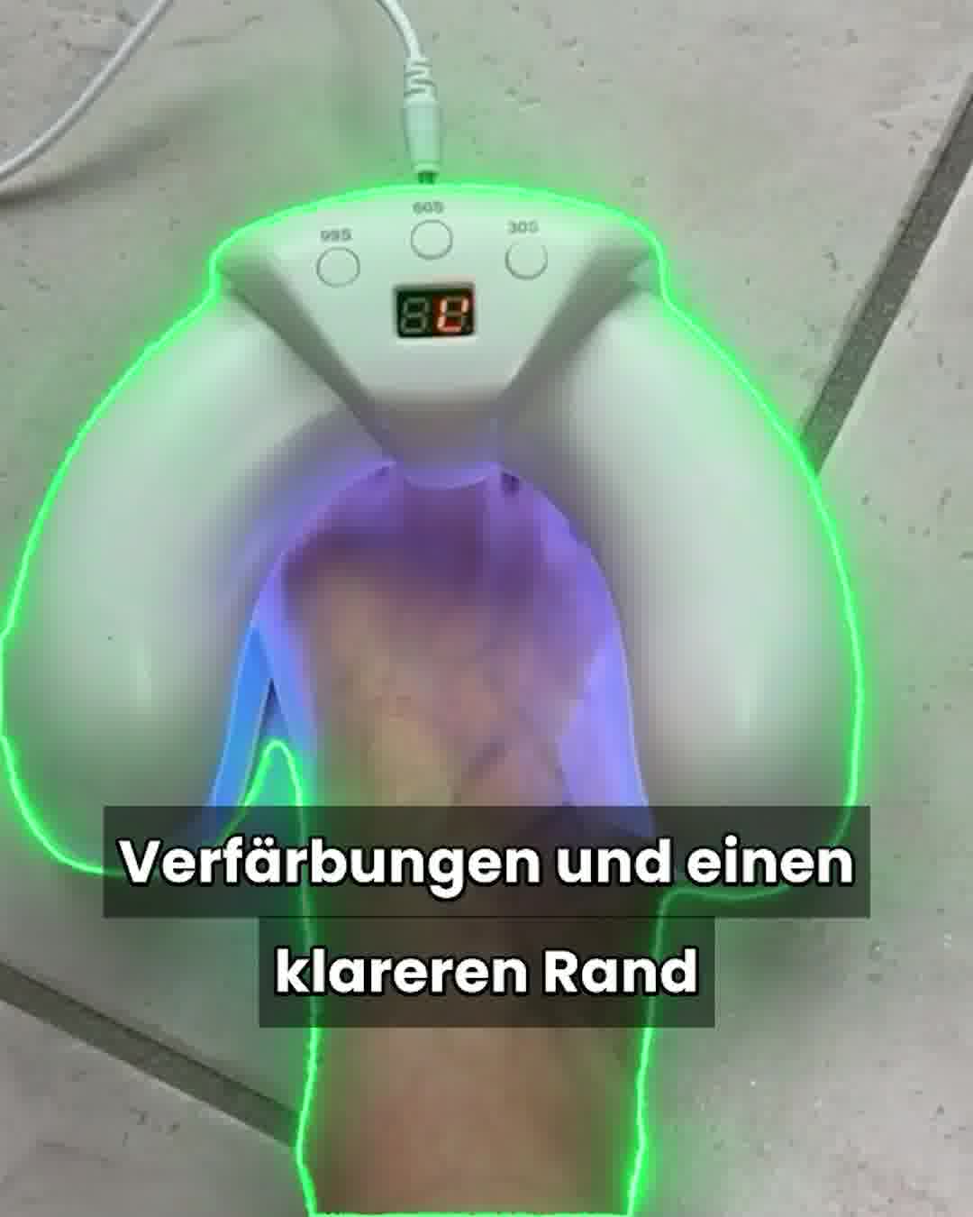 Mehr über die PhotoDerm-Technologie erfahren